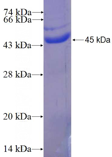 Recombinant Human EXOC7 SDS-PAGE