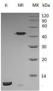 Vibrio cholerae ctxB/toxB/VC_1456 recombinant protein