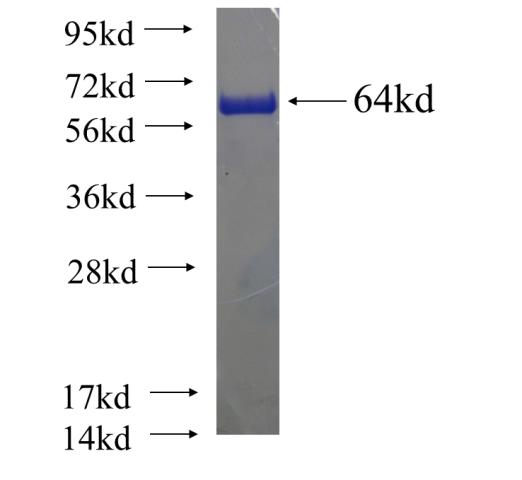 Recombinant human STIP1 SDS-PAGE