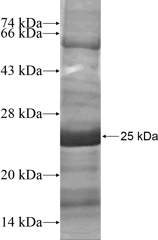 Recombinant Human TNMD SDS-PAGE