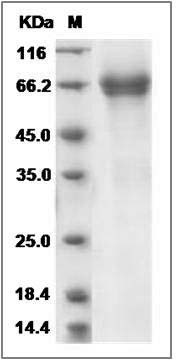 Rat IL7R / IL7RA Protein (Fc Tag) SDS-PAGE