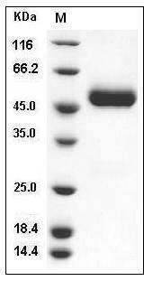 Rat CNTFR / CNTFR-alpha Protein (His Tag) SDS-PAGE