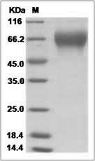 Influenza B (B/Wisconsin/01/2012) Hemagglutinin / HA1 Protein (His Tag)