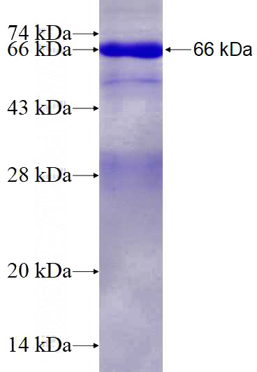 Recombinant Human MAPRE2 SDS-PAGE