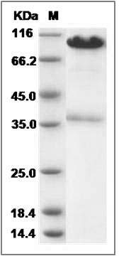 Human CALR / Calreticulin Protein (Fc Tag) SDS-PAGE