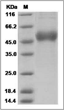Influenza A H15N2 (A/Australian shelduck/Western Australia/1756/1983) Hemagglutinin Protein (HA1 Subunit) (His Tag) SDS-PAGE