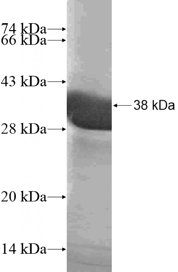 Recombinant Human LUZP2 SDS-PAGE