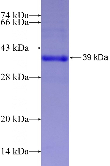 Recombinant Human GALNT8 SDS-PAGE