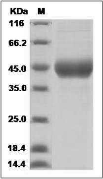 Influenza A H10N3 (A/mallard/Minnesota/Sg-00194/2007) Hemagglutinin Protein (HA1 Subunit) (His Tag) SDS-PAGE
