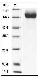 Influenza A H1N1 (A/Ohio/UR06-0091/2007) Hemagglutinin / HA Protein (His Tag) SDS-PAGE
