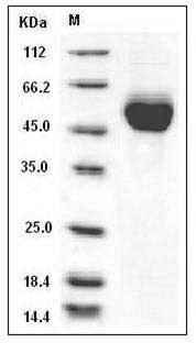 Influenza A H15N8 (A/duck/AUS/341/1983) Hemagglutinin Protein (HA1 Subunit) (His Tag) SDS-PAGE