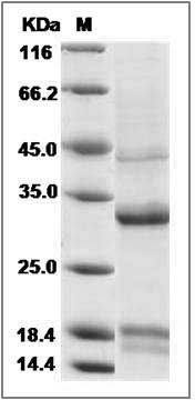 Cynomolgus Hemojuvelin / HFE2 Protein (His Tag) SDS-PAGE