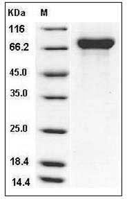 Influenza A H1N1 (A/England/195/2009) Hemagglutinin / HA Protein (His Tag) SDS-PAGE