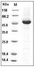 Human DOPA Decarboxylase / DDC Protein (His Tag) SDS-PAGE