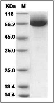 Rat CD36 / SCARB3 Protein (His Tag) SDS-PAGE