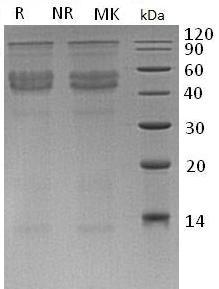 Human DMP1 (His tag) recombinant protein