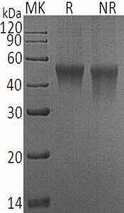 Mouse Fcrl1/Fcrh1/Ifgp1 (His tag) recombinant protein