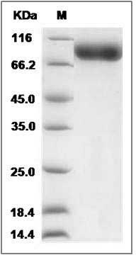 Cynomolgus IL18RAP Protein (Fc Tag) SDS-PAGE