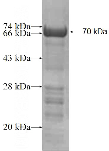 Recombinant Human KRR1 SDS-PAGE