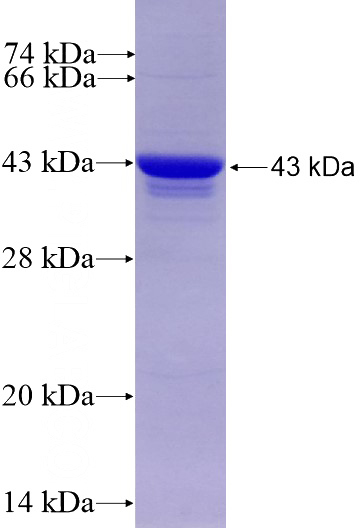 Recombinant Human ST7L SDS-PAGE