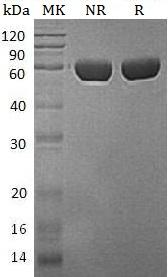 Human CPVL/VLP/PSEC0124/UNQ197/PRO223 (His tag) recombinant protein