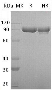 Human ITIH3 (His tag) recombinant protein