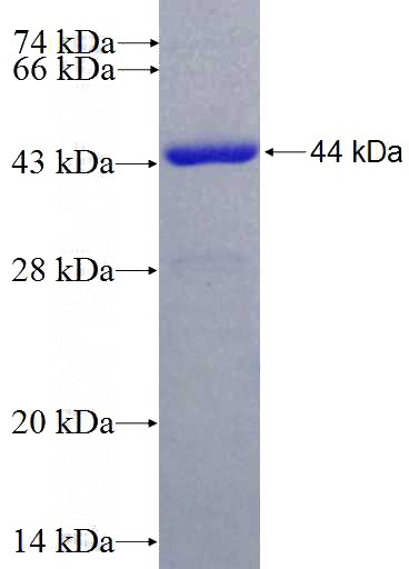 Recombinant Human ALDH2 SDS-PAGE