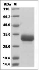 Mouse Ephrin B3 / EFNB3 Protein (His Tag) SDS-PAGE