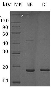 Human PPIL1/CYPL1/CGI-124/UNQ2425 (His tag) recombinant protein