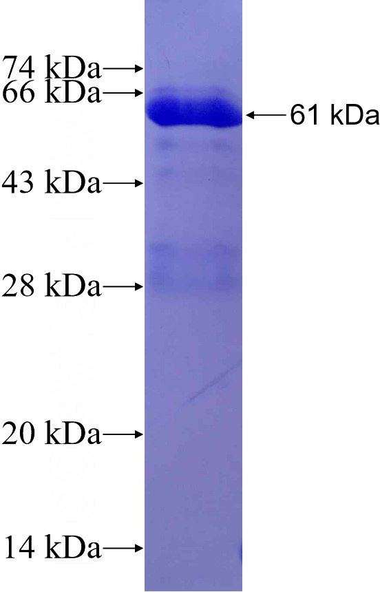 Recombinant Human CEP192 SDS-PAGE