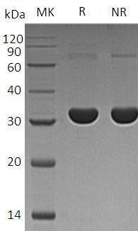 Human PBLD/MAWBP (His tag) recombinant protein