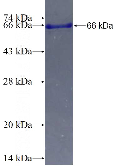 Recombinant Human HOMER1 SDS-PAGE