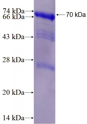 Recombinant Human STAG1 SDS-PAGE