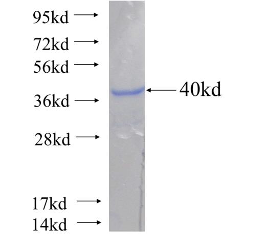 Recombinant human GS28(Full length) SDS-PAGE