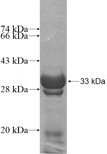 Recombinant Human UGT3A1 SDS-PAGE