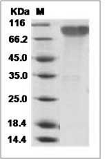 Epstein-Barr virus (Herpesvirus 4) EBV Glycoprotein gp350 / EBV GP350 Protein (His Tag)