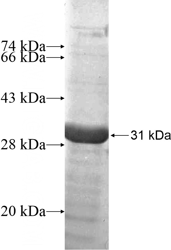 Recombinant Human SLITRK5 SDS-PAGE