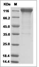 Human Interleukin-31 receptor A / IL31RA Protein (Fc Tag)