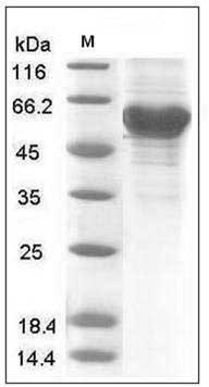 Human Ephrin-A3 / EFNA3 / EFL2 Protein (Fc Tag) SDS-PAGE
