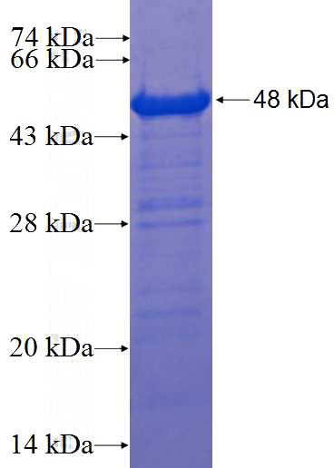 Recombinant Human MPHOSPH9 SDS-PAGE