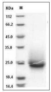Cynomolgus KIM-1 / TIM1 / HACVR1 Protein (His Tag) SDS-PAGE