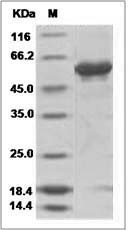Influenza A H16N3 (A/black-headed gull/Sweden/5/99) Hemagglutinin / HA Protein (His Tag)