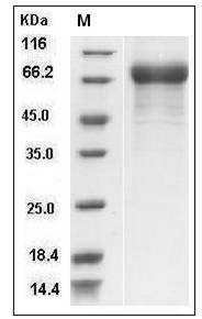 Influenza A H5N1 (A/Xinjiang/1/2006) Hemagglutinin / HA Protein (His Tag) SDS-PAGE