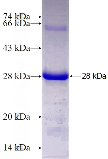 Recombinant Human C17orf68 SDS-PAGE