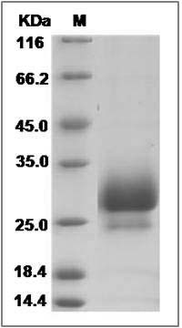 Mouse IFNL2 / IL28A Protein (His Tag) SDS-PAGE