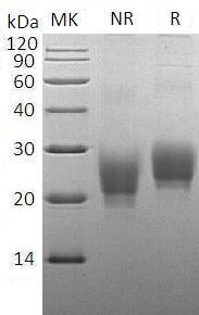 Cynomolgus TNFSF4/TNLG2B/EGK_01976 (His tag) recombinant protein