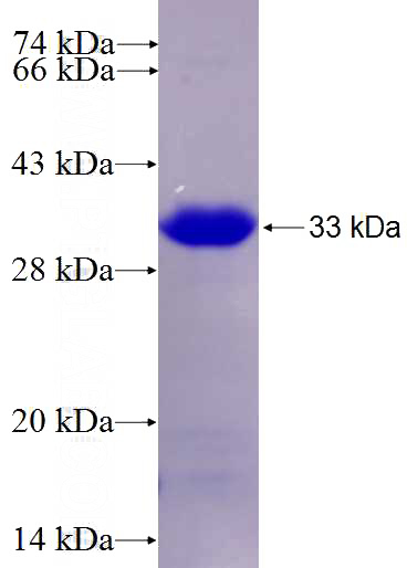 Recombinant Human C1orf2 SDS-PAGE