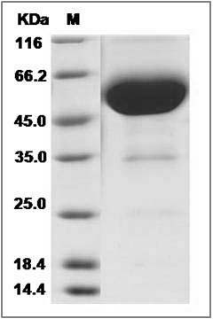 Human CD47 Protein (Fc Tag) SDS-PAGE