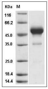 Rat IFNG / Interferon Gamma Protein (Fc Tag) SDS-PAGE