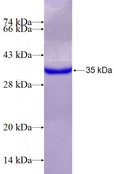 Recombinant Human CTNNBIP1 SDS-PAGE